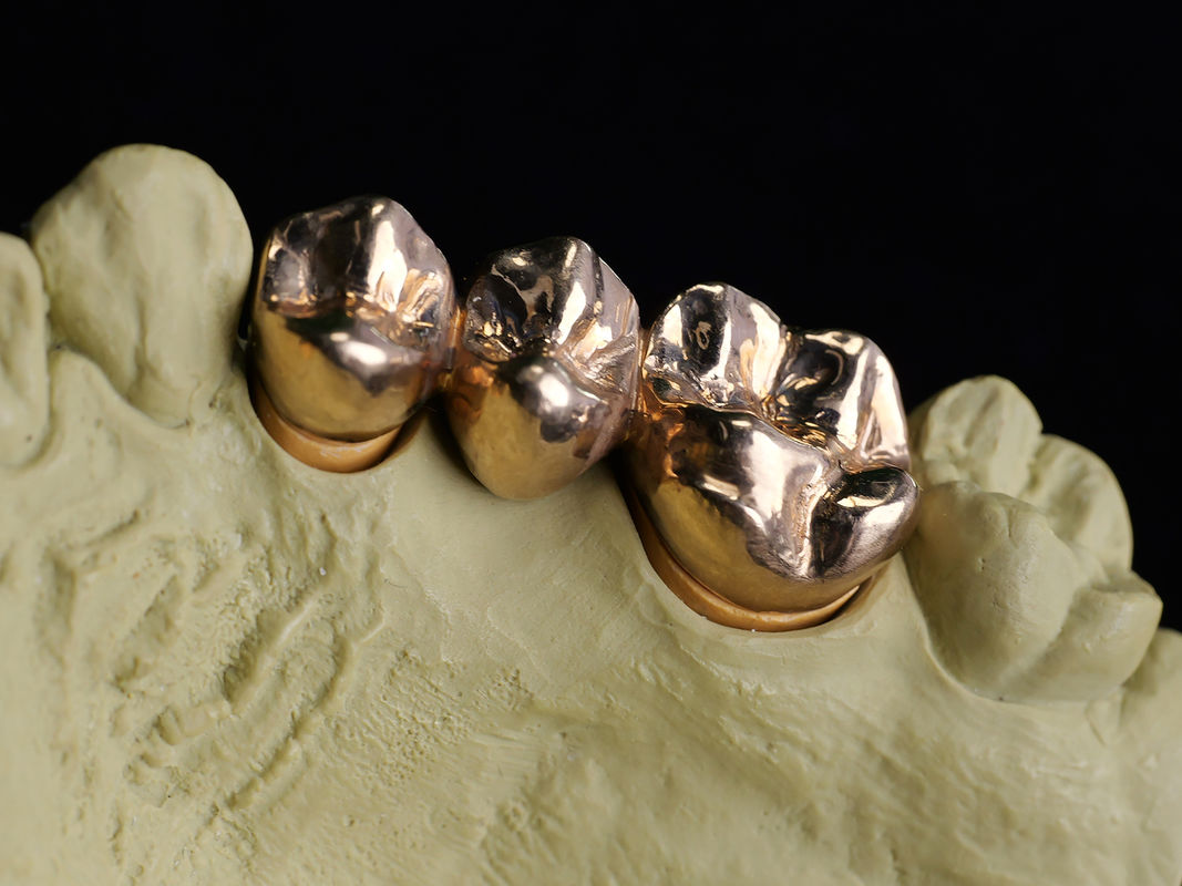Audental A75 (HIGH NOBL/Crown&Bridge alloy/Geel/Au75%)