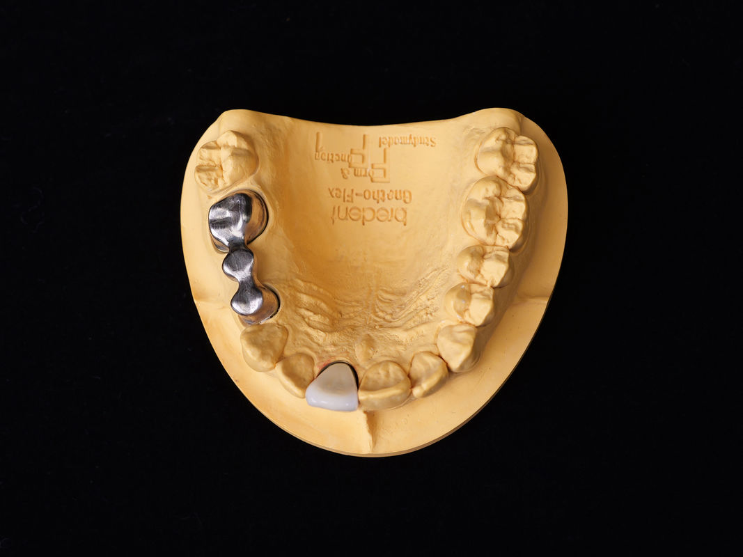 Audental 04 Nobele legering zilver-palladium porselein legering wit Pd53,3% voor langdurige tandheelkundige restauraties