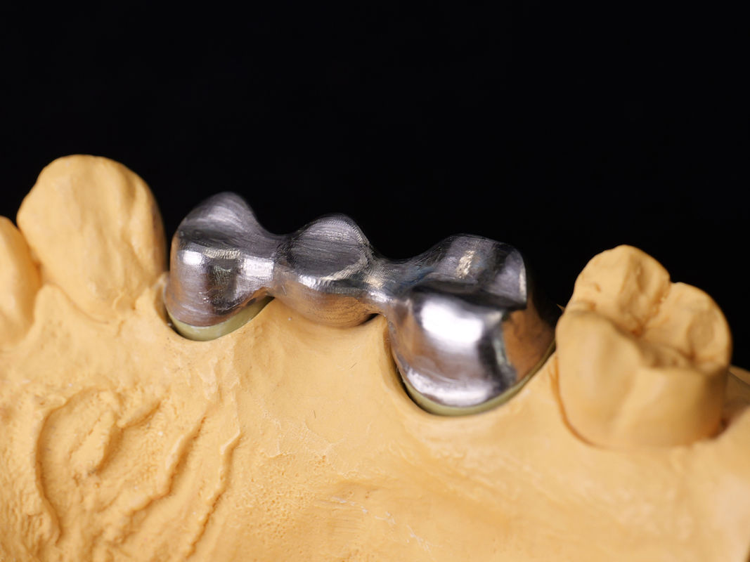 Audental 04 Nobele legering zilver-palladium porselein legering wit Pd53,3% voor langdurige tandheelkundige restauraties