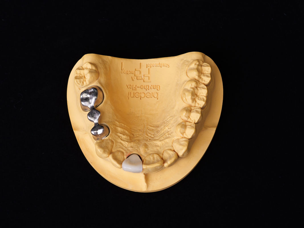 Audental 43 zilver-palladium porselein legering wit Pd43% edele legering voor sterke en esthetische tandheelkundige herstelwerkzaamheden