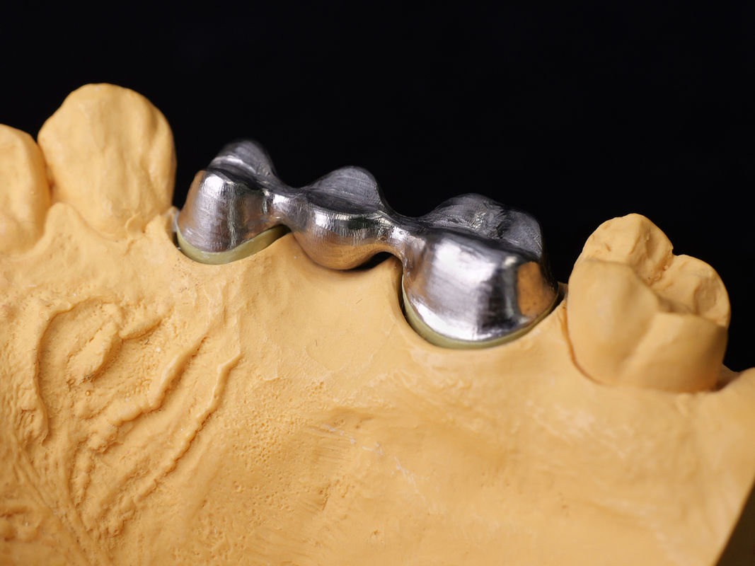 Audental 43 zilver-palladium porselein legering wit Pd43% edele legering voor sterke en esthetische tandheelkundige herstelwerkzaamheden