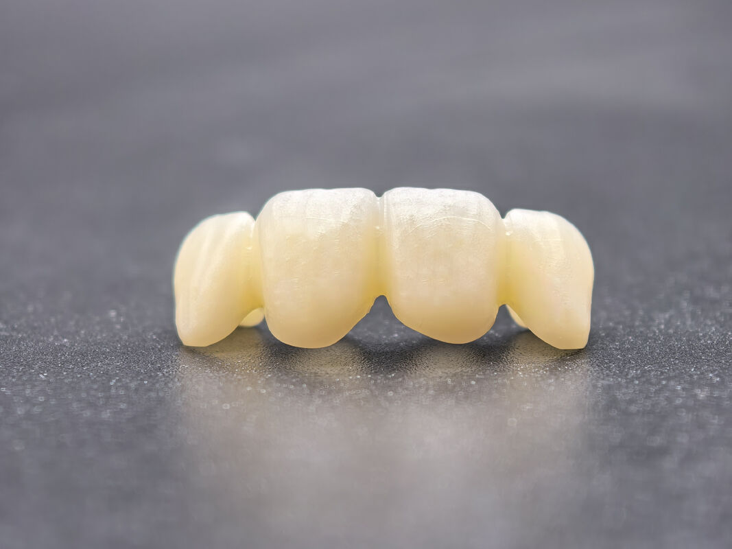 Zirkoniumblok voor Tandheelkunde met Geavanceerd Gradiëntontwerp en Chemische Stabiliteit voor Prestaties in Precisie CAD CAM Tandheelkundige Fabricage